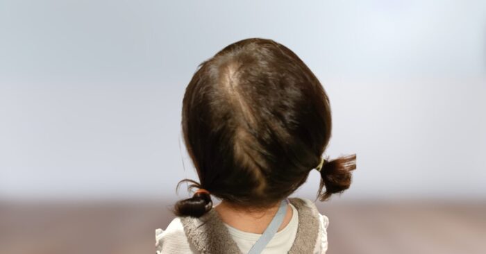 不器用ママでもできる！髪少なめ保育園児の平日5日分ヘアスタイル実例集