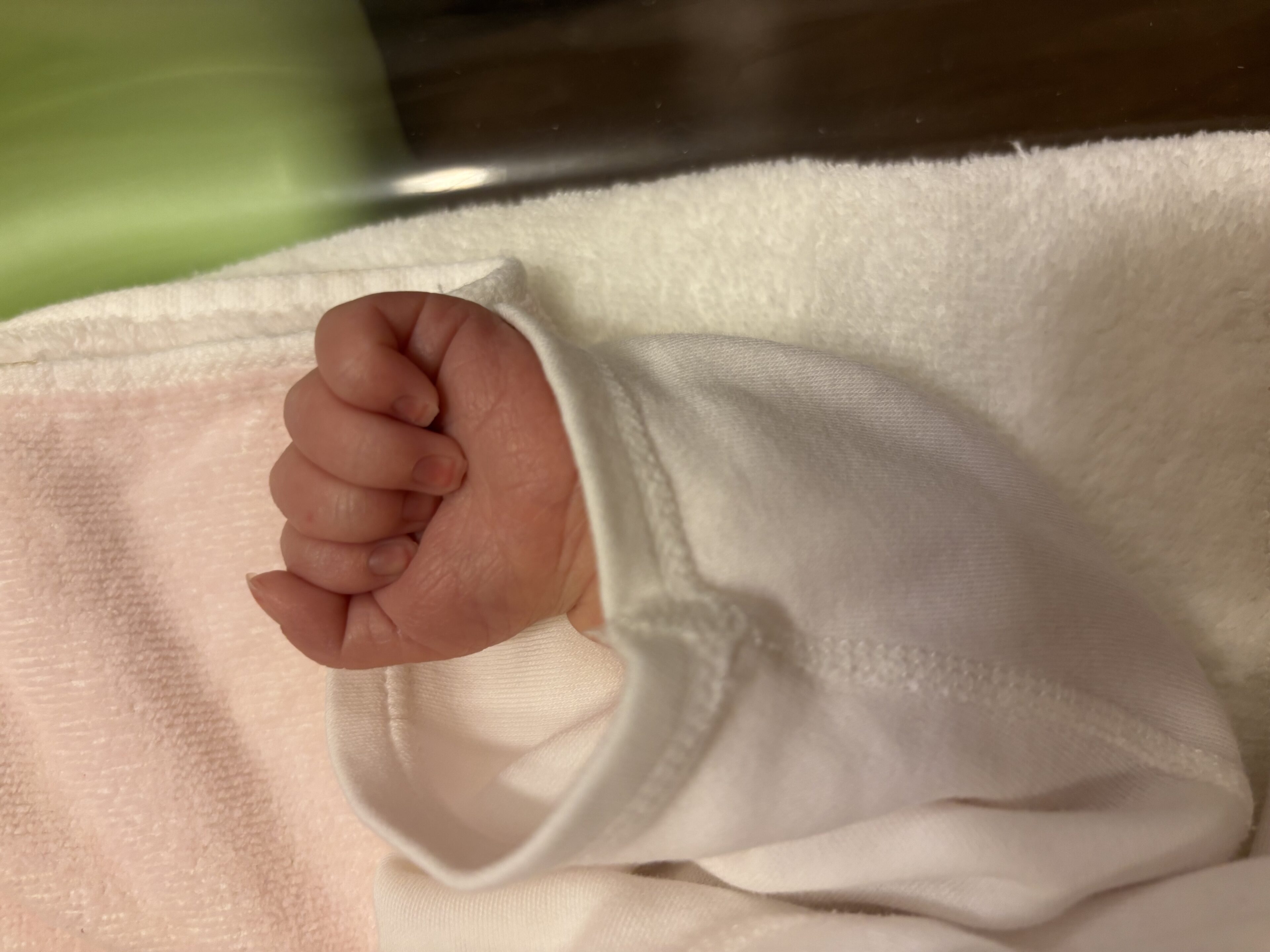 次女がふくらはぎに「赤いあざ」をもって生まれてきた話