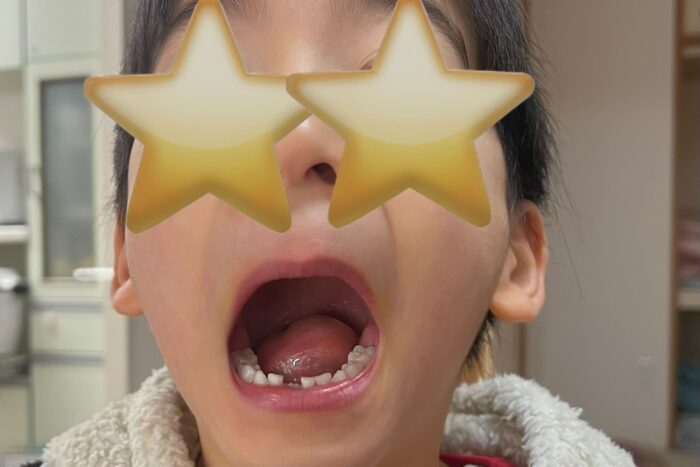 歯が抜けた日、家族4人それぞれの朝