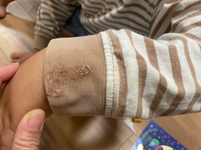 【大ピンチ】洋服にベッタリ付いたスライムを落とし方はコレ！