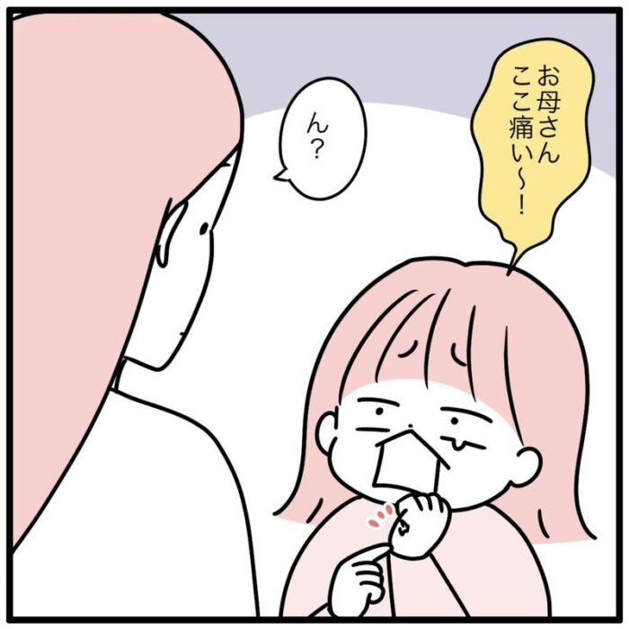 「ここ痛い〜」と言う娘の手を見ると？