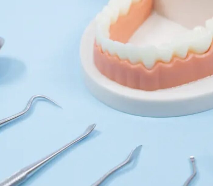 「虫歯がないから大丈夫」は40代の落とし穴！ 虫歯ゼロだった私が歯医者で焦った理由