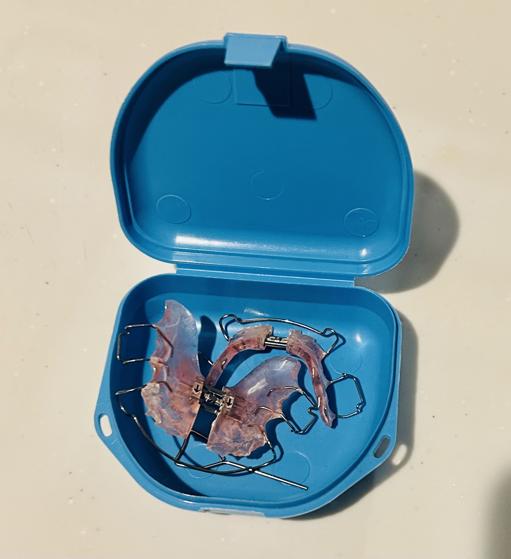 子どもの歯列矯正はいつから？側方拡大装置の体験談