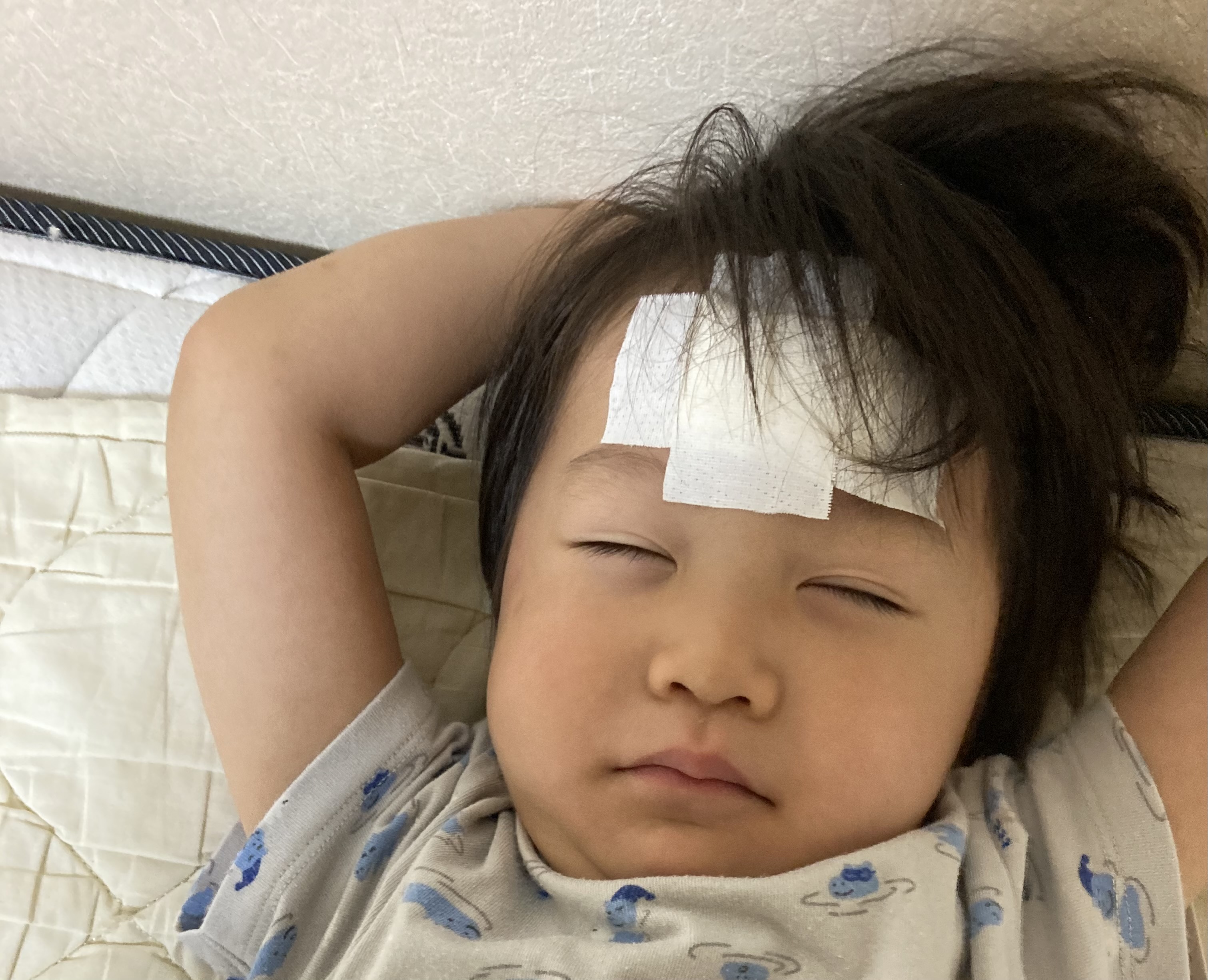 「この傷、残る？」7針縫ったあの日から5年。おでこの傷はどこまできれいに？