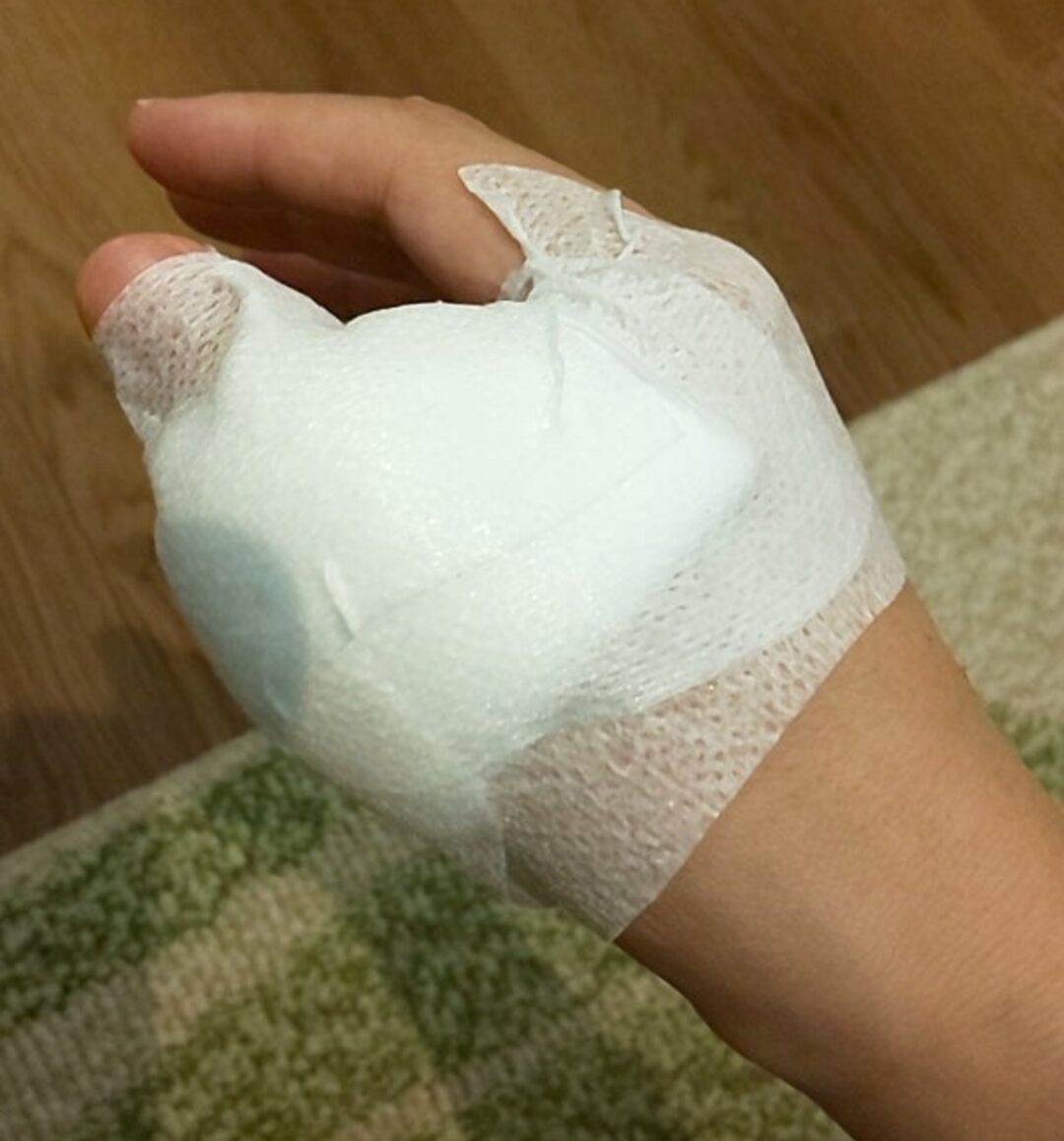 前触れもなく皿洗い中に大ケガ！まさか救急へ行くことになるなんて…