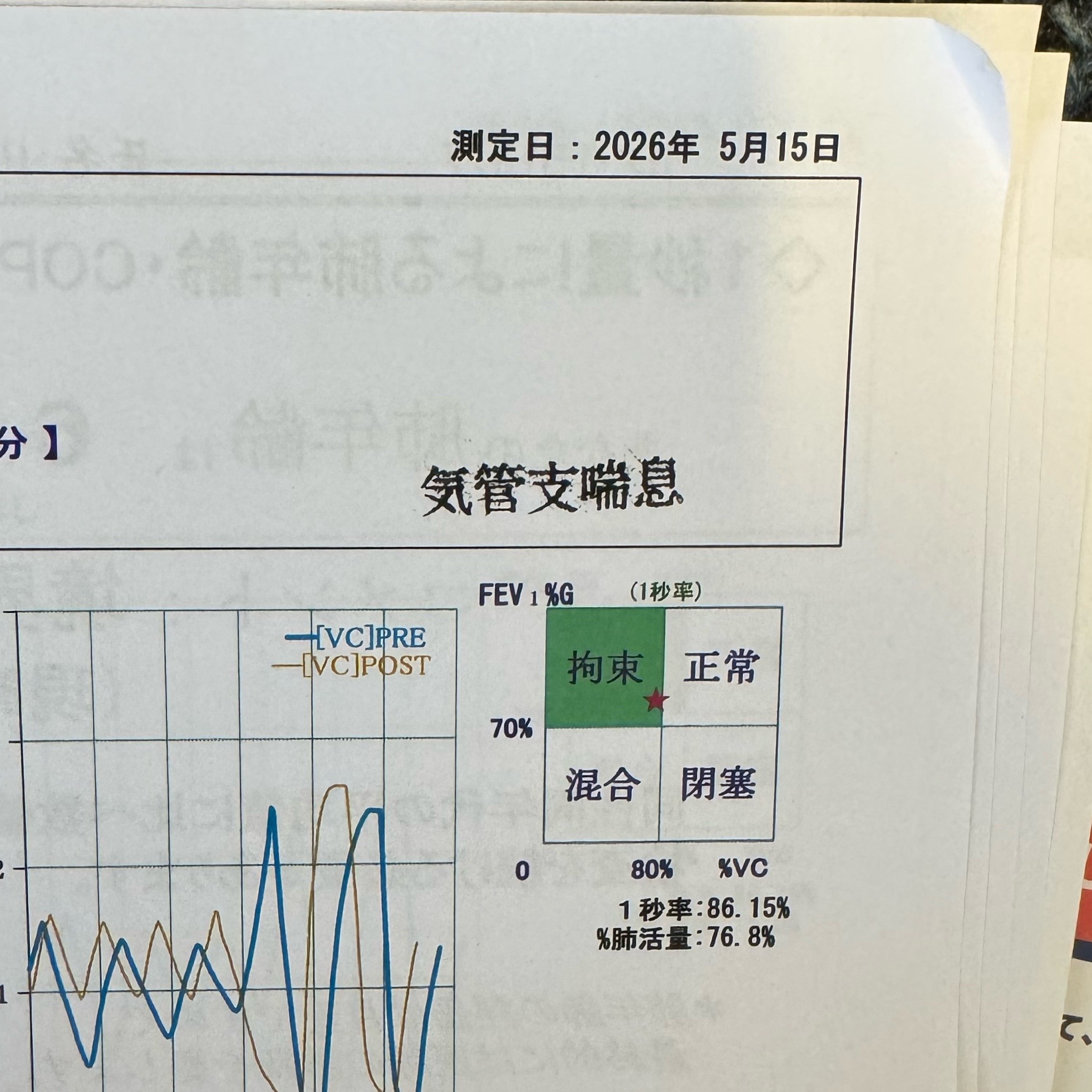 痰が絡む長引く咳…風邪じゃなかった話