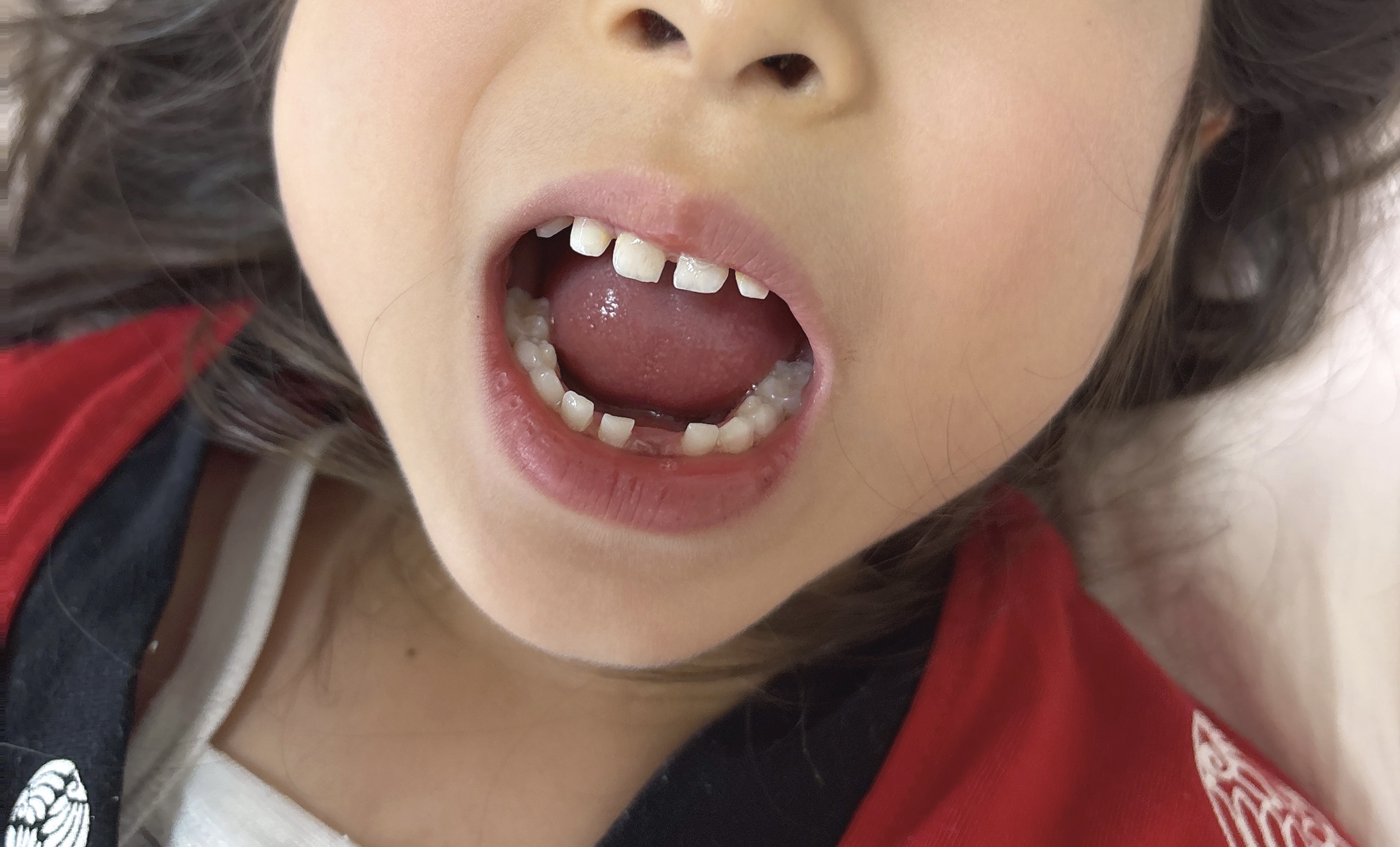 姉の歯が抜けた。弟が泣いた理由に、姉弟の絆を感じた日