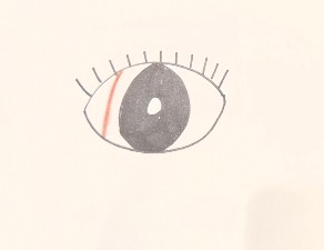 目に異物!?長さ〇センチのアレが出てきて衝撃を受けた話