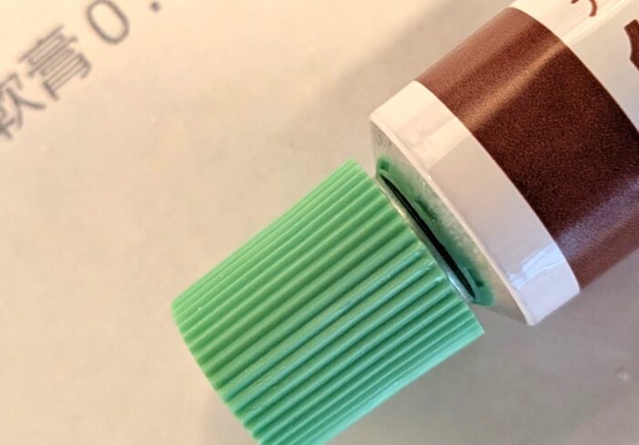 30年以上前にかかった病気が再び！？皮膚科で告げられたのはまさかの帯状疱疹